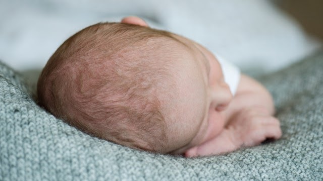  Bentuk  Kepala  Normal Bayi Baru Lahir Seputar Bentuk 