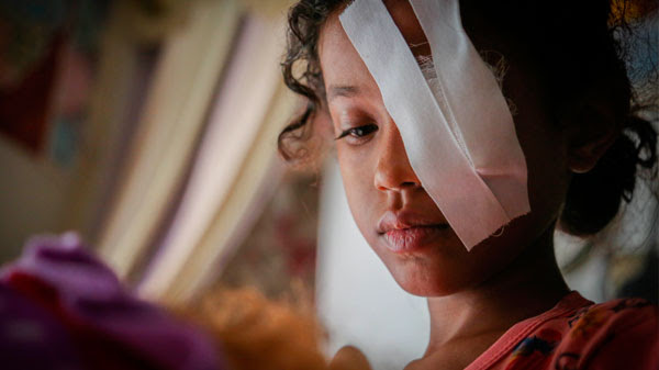 Razan tiene 8 años y acaba de perder un ojo