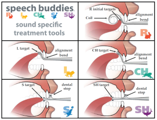 To determine if you have a lisp, listen and look very carefully at a couple of peers, particularly adults and see how your or your child's s sound differs from these peers. Understanding Dentalized Lisps