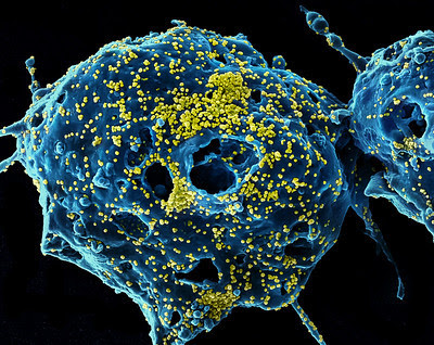 Photo caption: Colorized scanning electron micrograph of Middle East Respiratory Syndrome virus particles 
