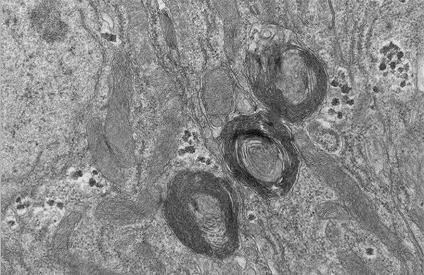 A black and white microscopic image of three PXo bodies in a mature enterocyte of the fly midgut epithelium