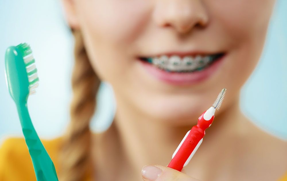 How To Brush Your Teeth With Braces Happy Living