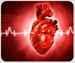 New tests accurately detect heart disease and adverse cardiac events in diabetic patients