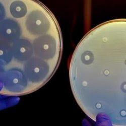 cdc director superbug antibiotics frieden intv super tease