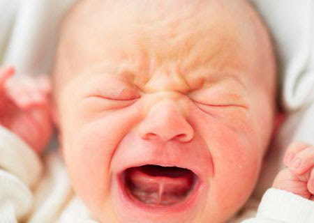 Anquiloglosia, el frenillo lingual de los bebés