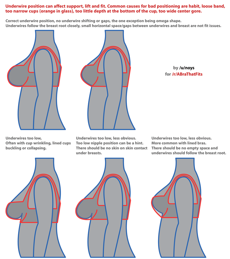 They can be caused by a bra in the wrong size or a bra style that just isn't right for you. Hugs For Your Jugs Bra Science 11 Signs You May Be Wearing A Boob Hat