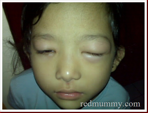 Ubat Allergic - Deepavalino