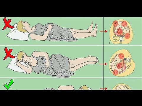 Payudara Nyeri Sebelah Kiri Tanda Apa / Sakit Tulang Belakang Tembus Ke