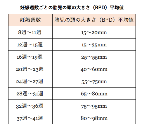 イメージカタログ 最新のhd 胎児 Bpd 大きい
