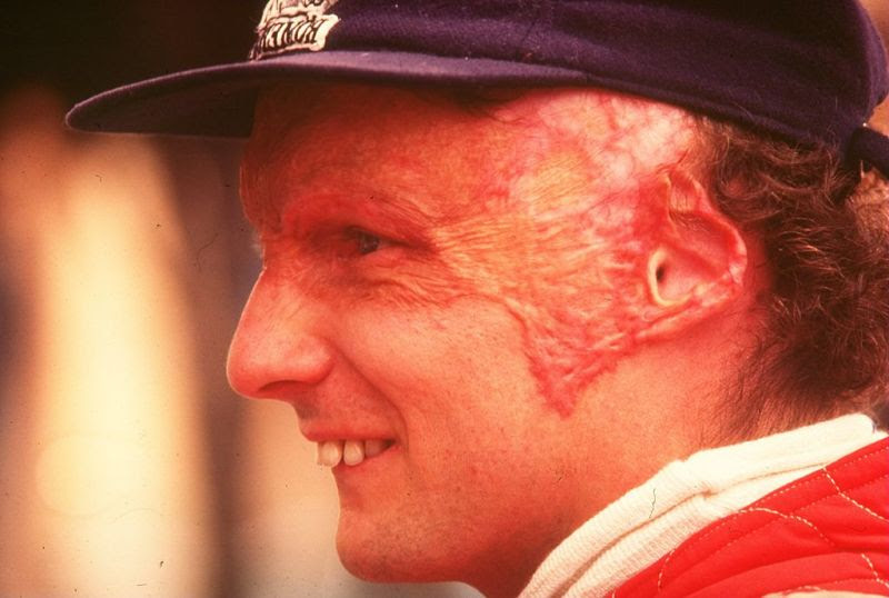 After starting out with a mini, lauda moved on into formula vee, as was normal in central europe, but rapidly moved up to drive in private porsche and chevron. The Scarface Hero 40 Years From Niki Lauda S Crash Mercedesblog