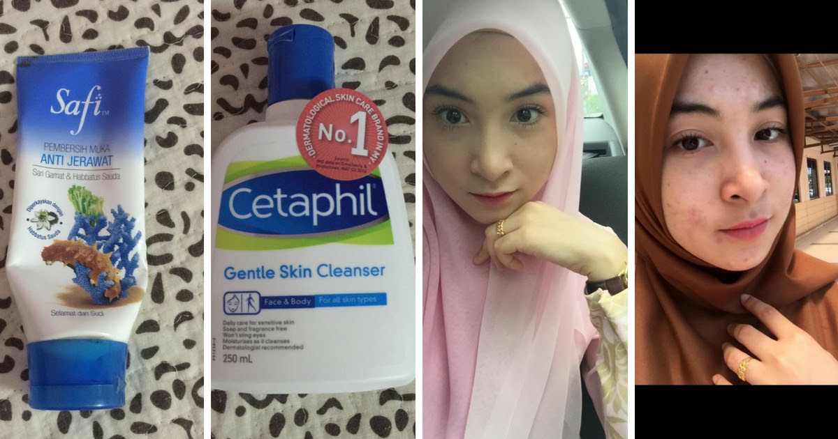 Ubat Jerawat Dan Jeragat - Kuching k