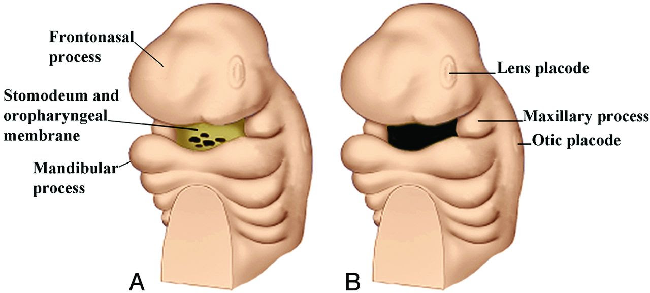The cartilaginous septum extends from the nasal bones in the midline above to the bony septum in the. Illustrated Review Of The Embryology And Development Of The Facial Region Part 1 Early Face And Lateral Nasal Cavities American Journal Of Neuroradiology