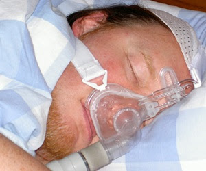 Researchers develop new tool to screen for sleep apnea in people with epilepsy