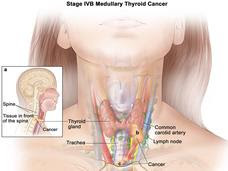 Anatomy of the throat showing thyroid gland