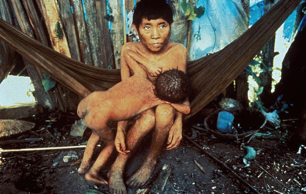 Os Yanomami foram anteriormente devastados por surtos de doenças mortais após invasões de seu território por garimpeiros.