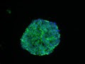 Spheroids Cultured Under Hypoxia