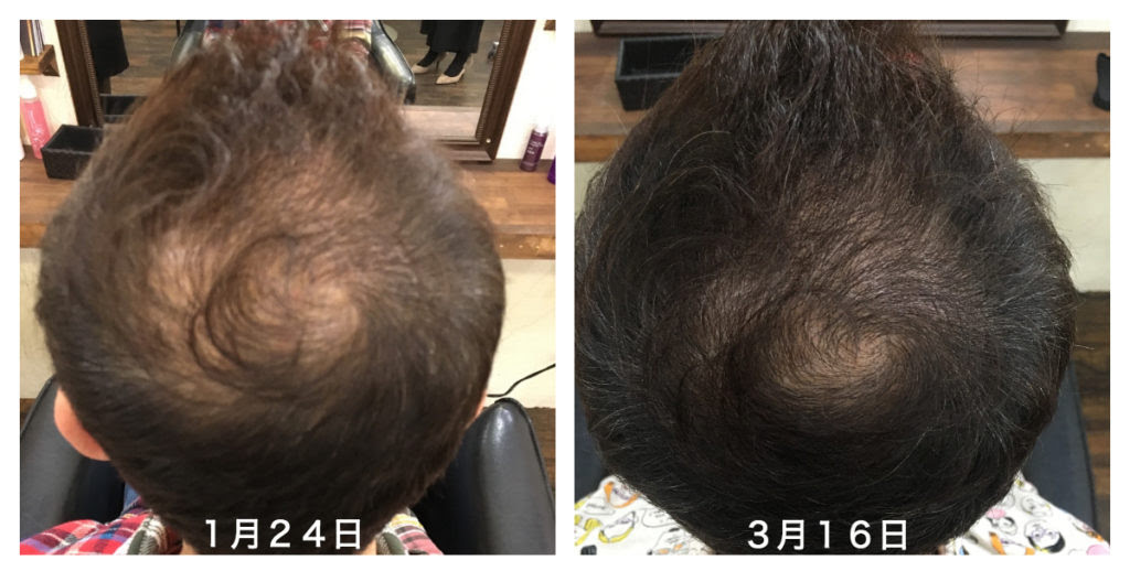 ファッショントレンド トップ100 薄毛 女性 シャンプー