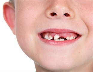 Scanning children's teeth may predict future mental health issues