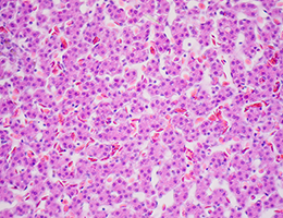 Hepatocytes