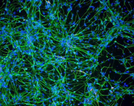 Check spelling or type a new query. Animal Cell Under A Microscope Photosynthetic Prokaryot