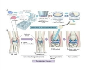 Researchers report new regenerative medicine approach for treating osteoarthritis of the knee