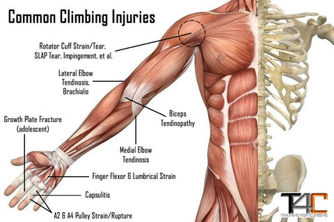 The wiring diagram that produces this behavior is illustrated in figure 4.4.6. Tendon Ligament Plasticity In Strength Power Athletes