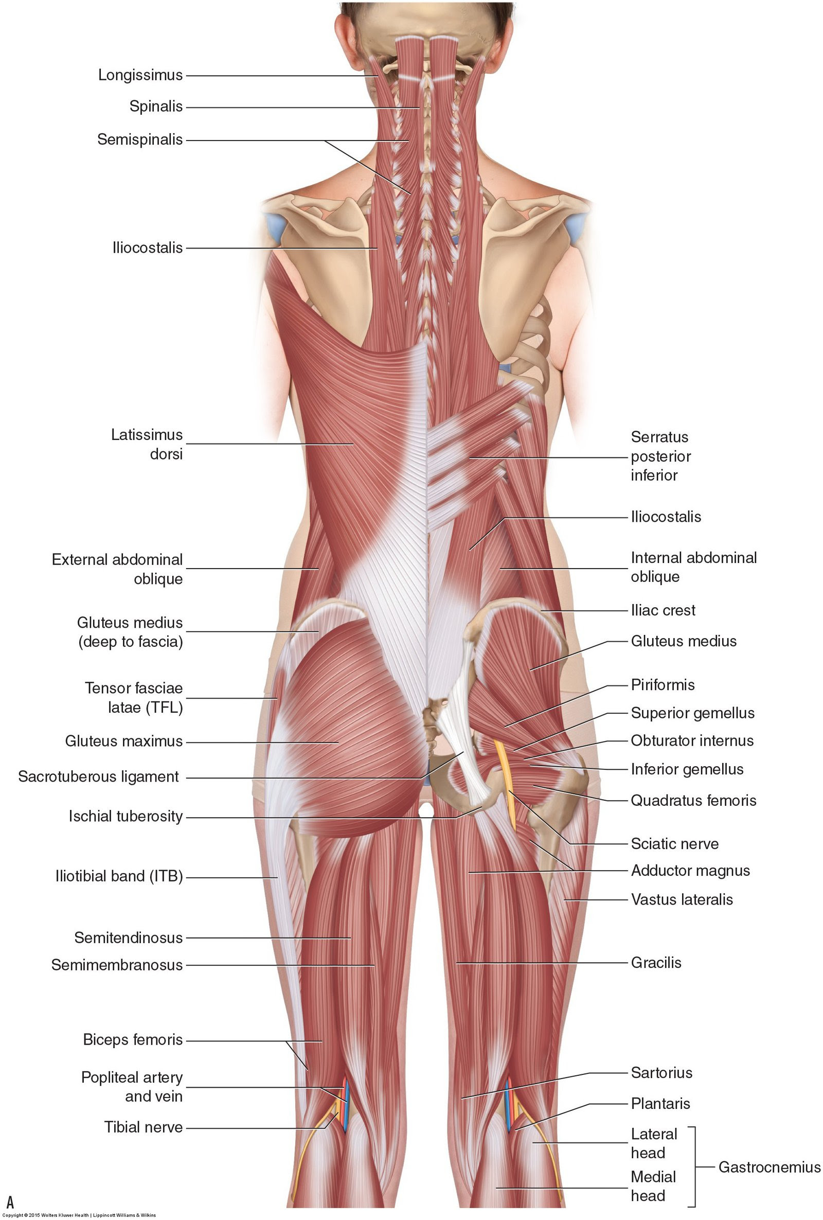Acute low back pain is most often caused by a sudden injury to the muscles and ligaments supporting the back. Muscles Of The Lumbar Spine Of The Trunk