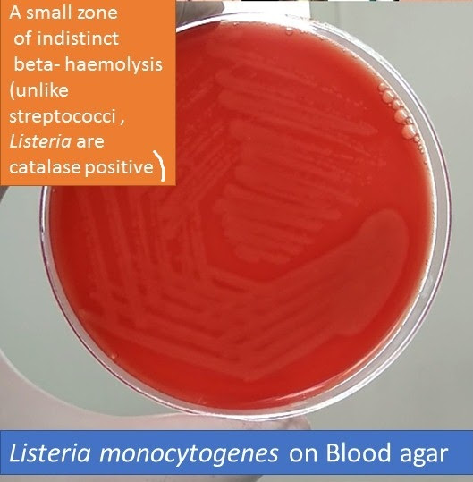 Listeria monocytogenes is the species of pathogenic bacteria that causes the infection listeriosis. Listeria Monocytogenes Introduction Morphology Culture Characteristics