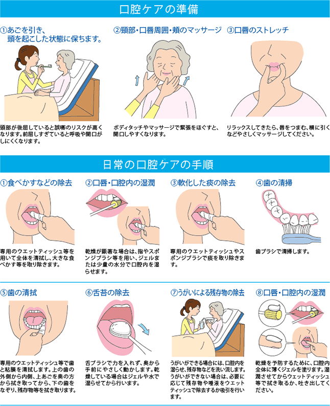 新鮮な口腔ケア 手順 イラスト すべての動物画像