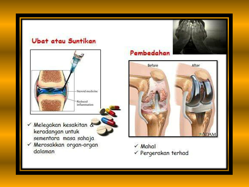 Ubat Gastrik Tablet - Omong x