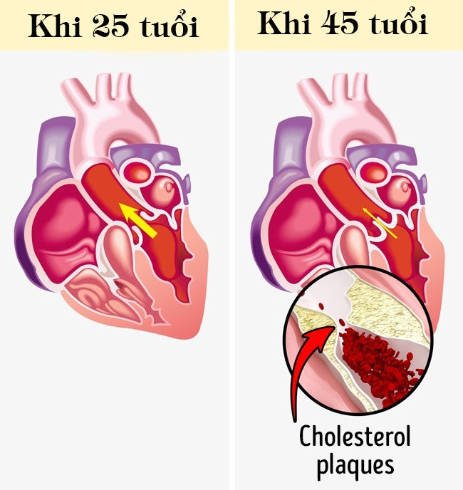 Hệ thống tim mạch