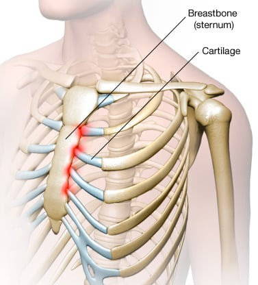 It is made up of the ribs that articulate at the back with the vertebral column (vertebrae) and at the front with the breastbone (sternum). 14 Causes Of Pain Under Right Rib Cage