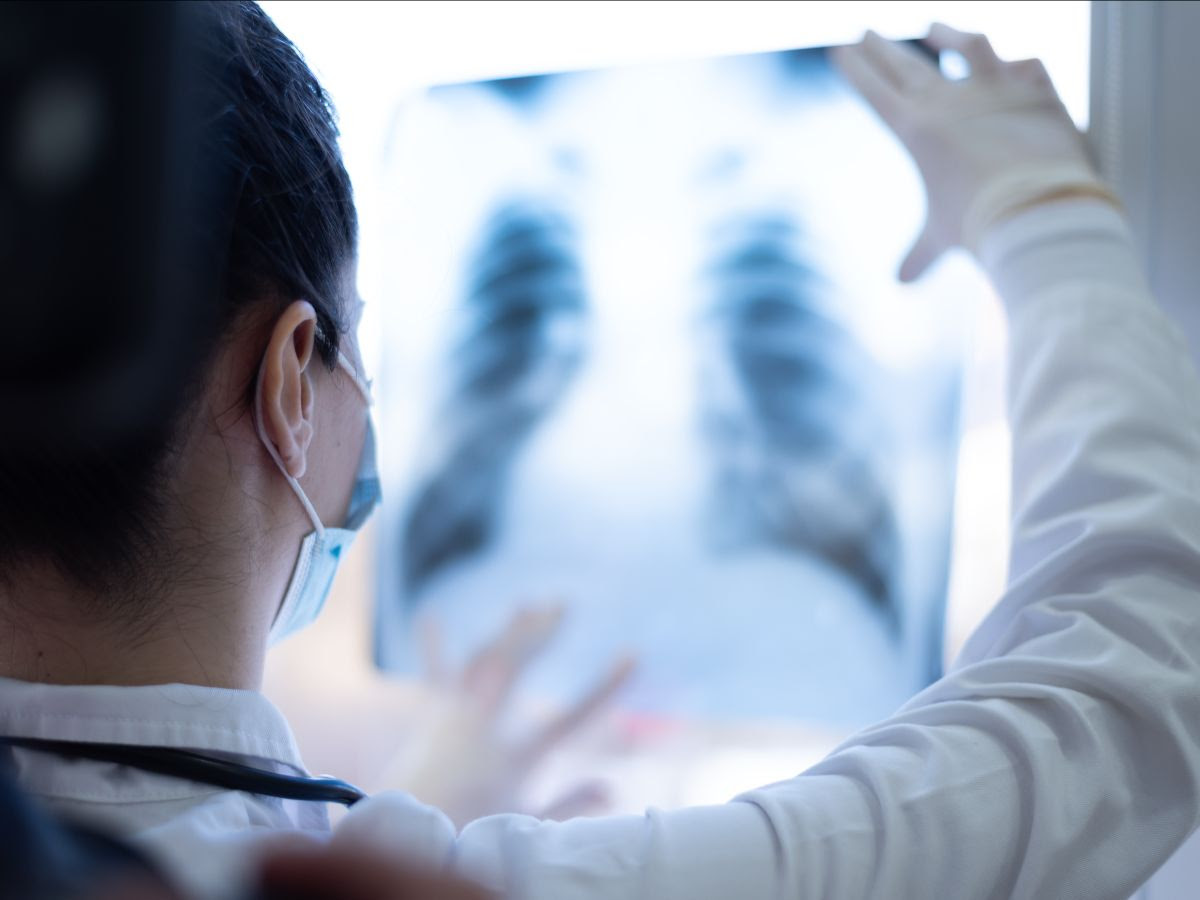 Healthcare professional examining lung x-ray