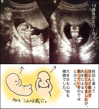 すべてのカタログ 新しい 妊娠 13 週 性別
