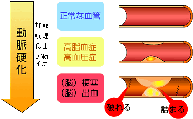 35 血管 イラスト 無料 興味深い画像の多様性