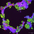 Mimicking Multiple Myeloma