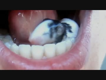 Girl Swallow Live Mouse Toxoplasmosis