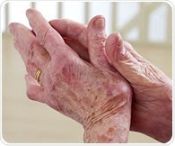 Researchers identify new clues on tissue damage in rheumatoid arthritis and lupus