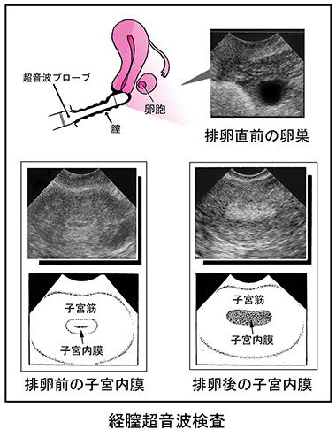 最良かつ最も包括的な 子宮 超音波 画像 見方 画像 Jp
