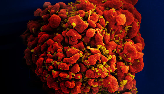 HIV-infected T cell