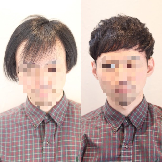 はげ 髪型 メンズ の最高のコレクション 人気のヘアスタイル
