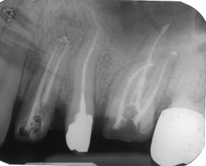 We did not find results for: Dentista In Rete Endodonzia Devitalizzazioni