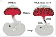 Dysfunctional placenta can contribute to Cornelia de Lange syndrome