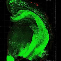 Brain Imaging Microscopy Clip