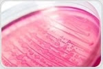 Human microbiome metabolites enhance colon injury by enterohemorrhagic E. coli, study shows