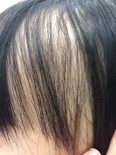 美しい花の画像 無料ダウンロード子供 の 円形 脱毛