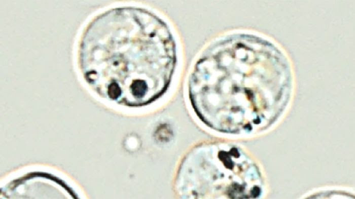 Poterioochromonas malhamensis et nano-argent