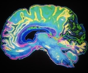 Regular head circumference assessment of preterm babies can help identify long-term IQ problems