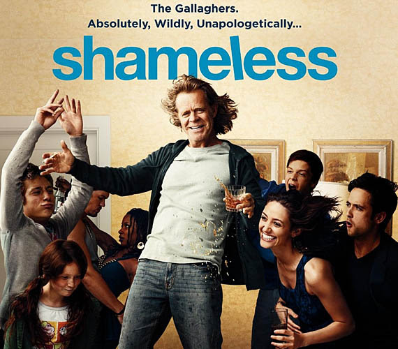 Shameless (Besmrtnici) - Serije Online sa Prevodom