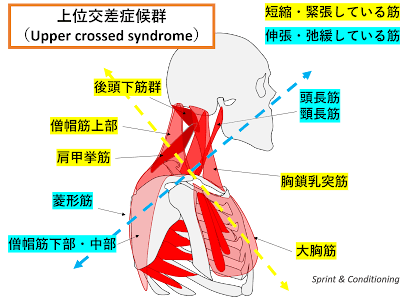 [最も選択された] 腕上げ イラスト 288245-腕上げ イラスト